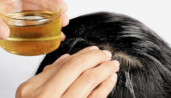 3 cách dùng dầu dừa trị rụng tóc hiệu quả bất ngờ
