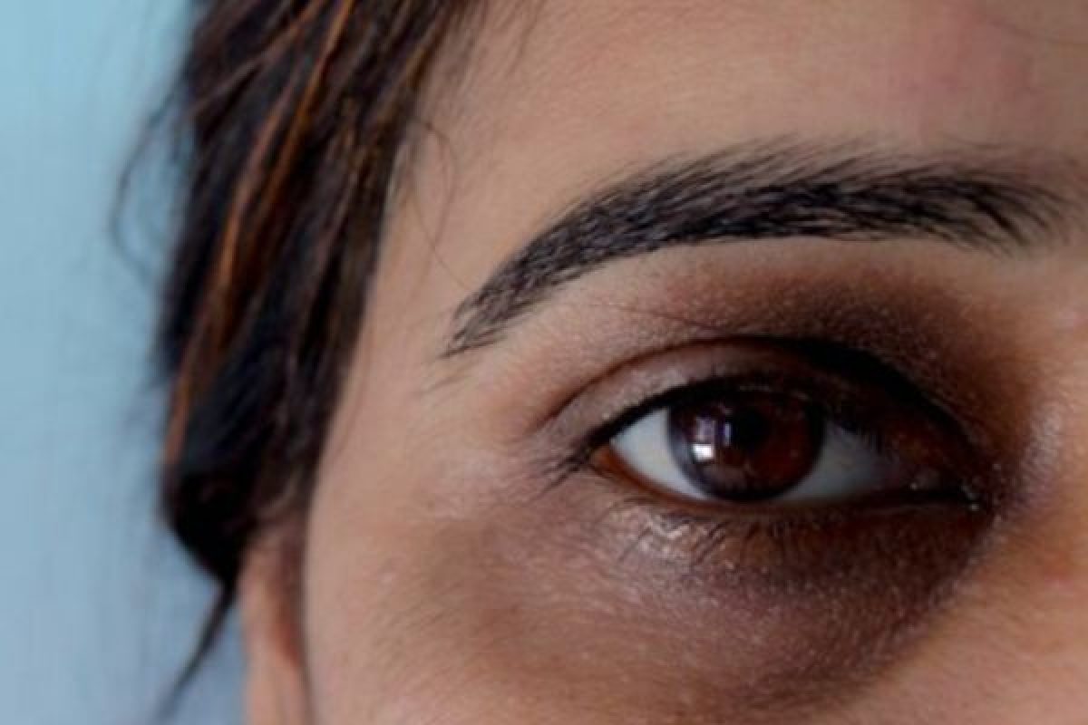 Thâm quầng mắt là bệnh gì? Cách trị thâm mắt tại nhà - Blog Thể Thao HCM