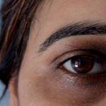 Thâm quầng mắt là bệnh gì? Cách trị thâm mắt tại nhà