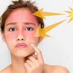 Những tác hại của tia UV đối với cơ thể