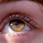 Mắt thâm quầng là bệnh gì?