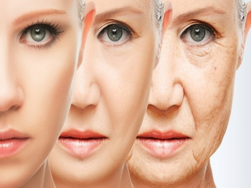 Tuổi tác được xem là nguyên nhân lớn nhất gây thiếu hụt collagen