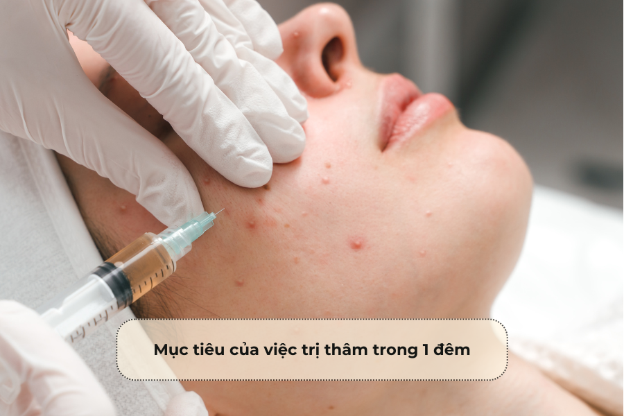 Mục tiêu của lượng giá trị trong 1 đêm