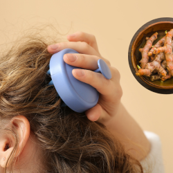 kích thích mọc tóc bằng gừng_