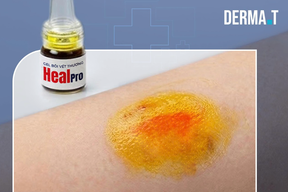 Derma.T HealPro nằm ở bước bảo vệ phục hồi bề mặt vết thương